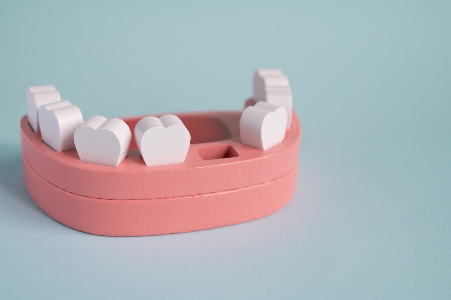 image of a missing tooth in a toy, replacing missing teeth, missing tooth replacement